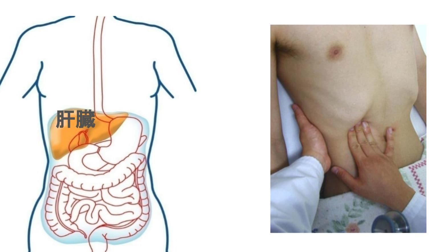 肝臓の触診|大阪福島区玉川の内科クリニック